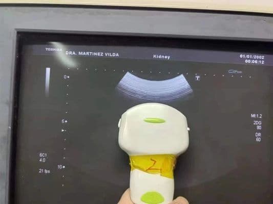 Toshiba PVU-375BT Convex Array Ultrasound Transducer thumbnail 4