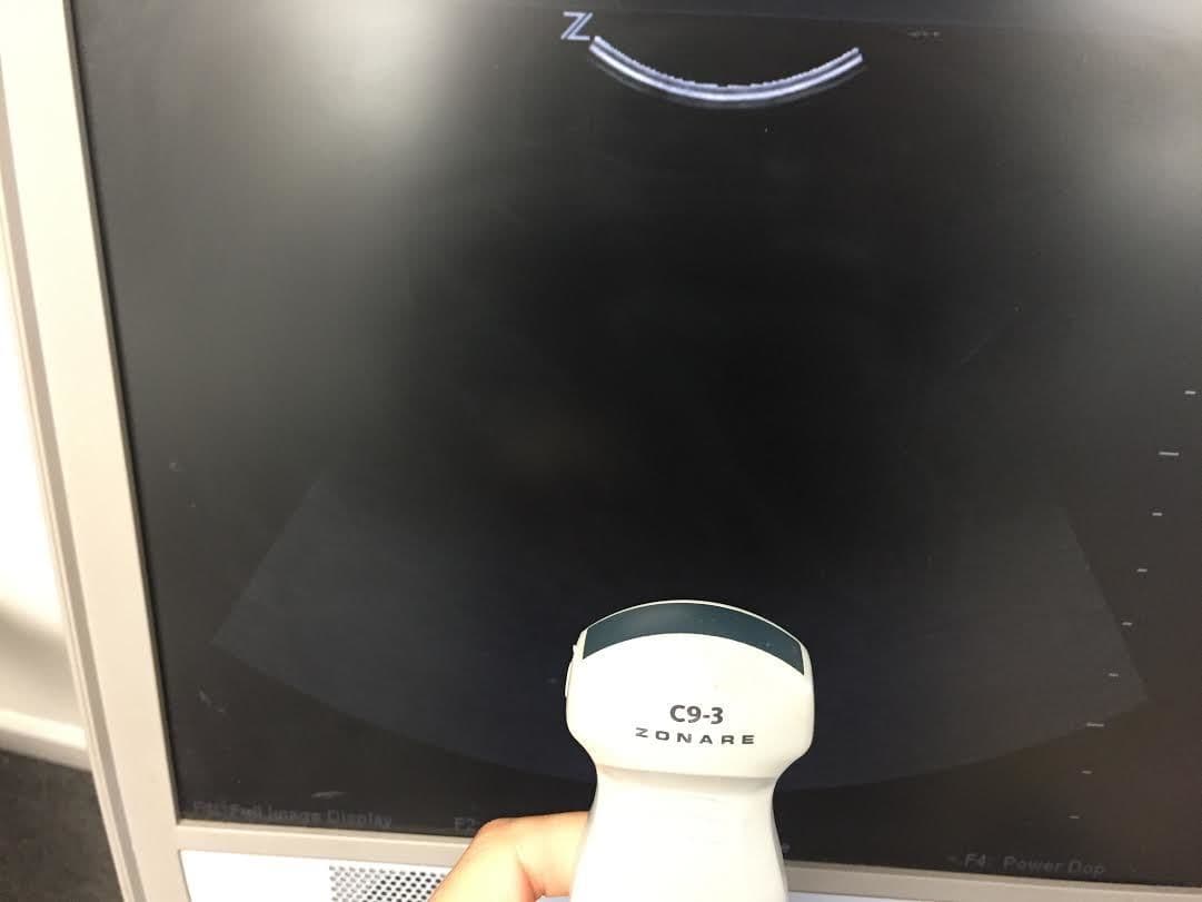 Zonare Z.One Ultrasound System thumbnail 5