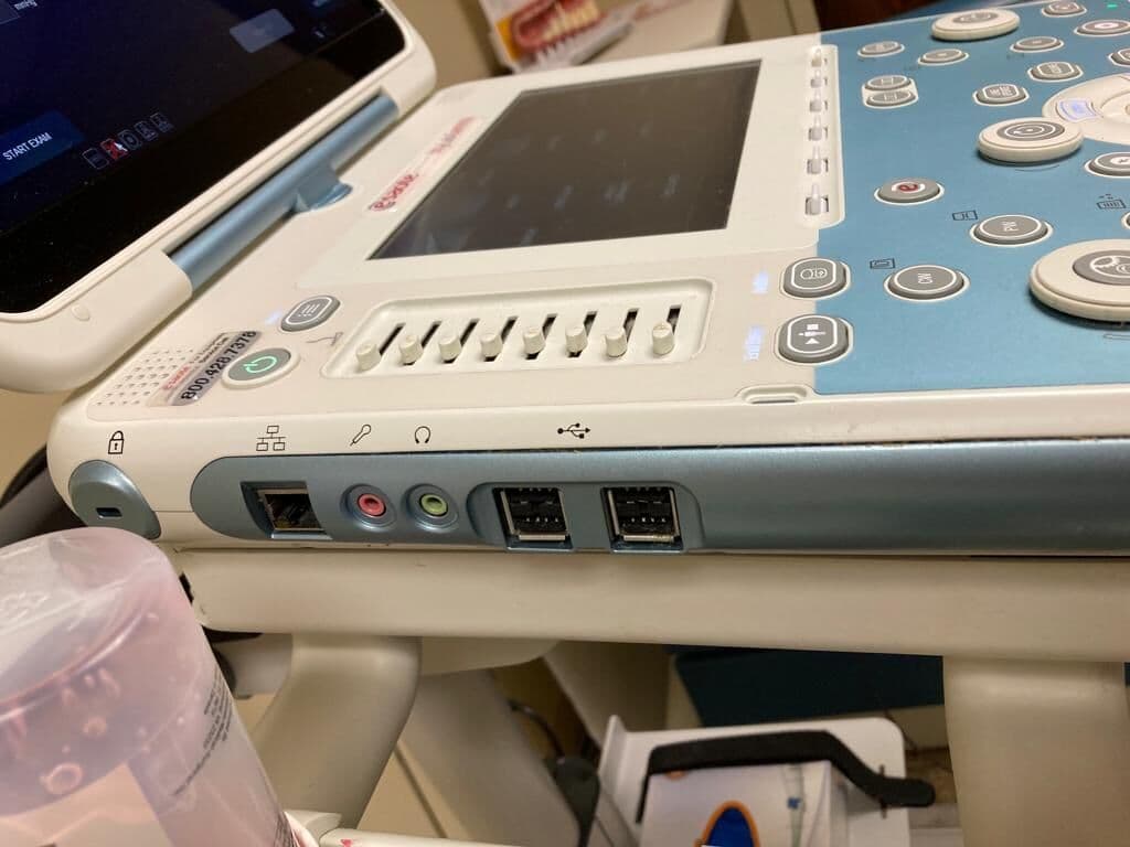 Esaote MyLab Gamma Portable Cardiac Ultrasound System thumbnail 4