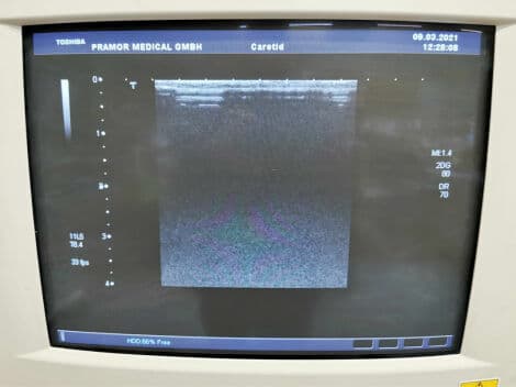 Toshiba PLT-704AT Linear Ultrasound Transducer thumbnail 7