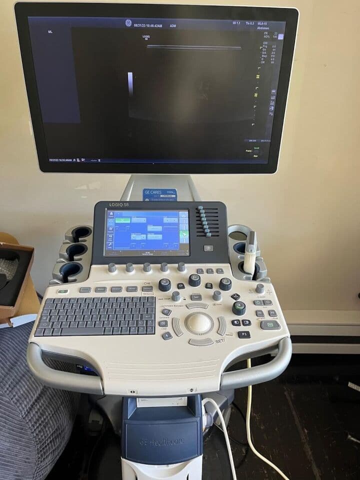 GE Logiq S8 XDclear Ultrasound System for Clinical Imaging thumbnail 5