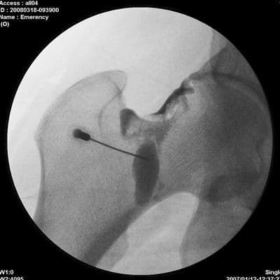 Genoray New Zen 7000 Mobile C-Arm Fluoroscopy System thumbnail 4