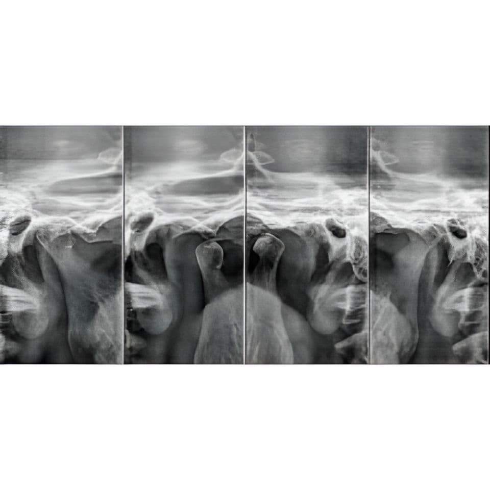 Carestream CS8100 Pano Panoramic Dental X-Ray System thumbnail 5