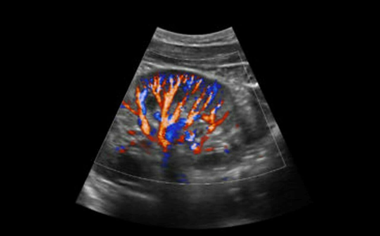 SonoScape X5 Portable Ultrasound System thumbnail 7
