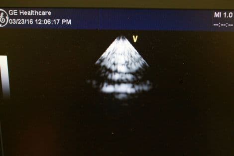GE 3S-RS Phased Array Cardiac Ultrasound Transducer thumbnail 5