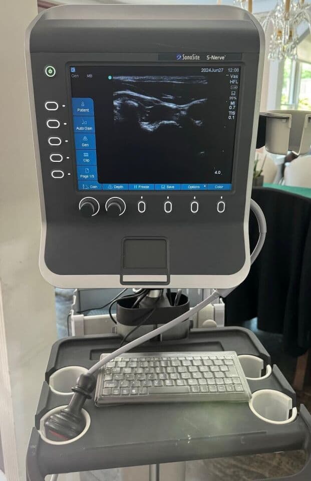 Sonosite S-Nerve Ultrasound System with Cart and L38x Vascular Probe thumbnail 3
