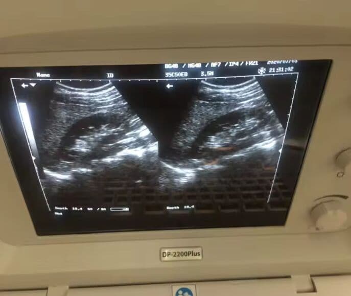 Mindray DP2200 Plus Portable Ultrasound Scanner thumbnail 2