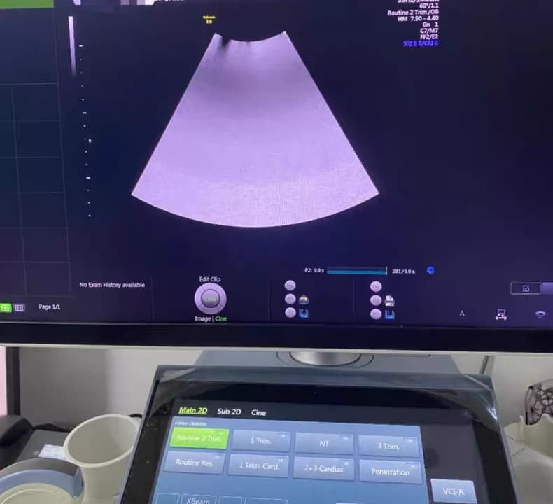 GE Voluson E8 Voluson E10 EC320 ultrasound machine repair RFM423 beamformer board) Artifact Imaging or no echo (KTZ304074 / 5729200 / KTZ304142) thumbnail 2