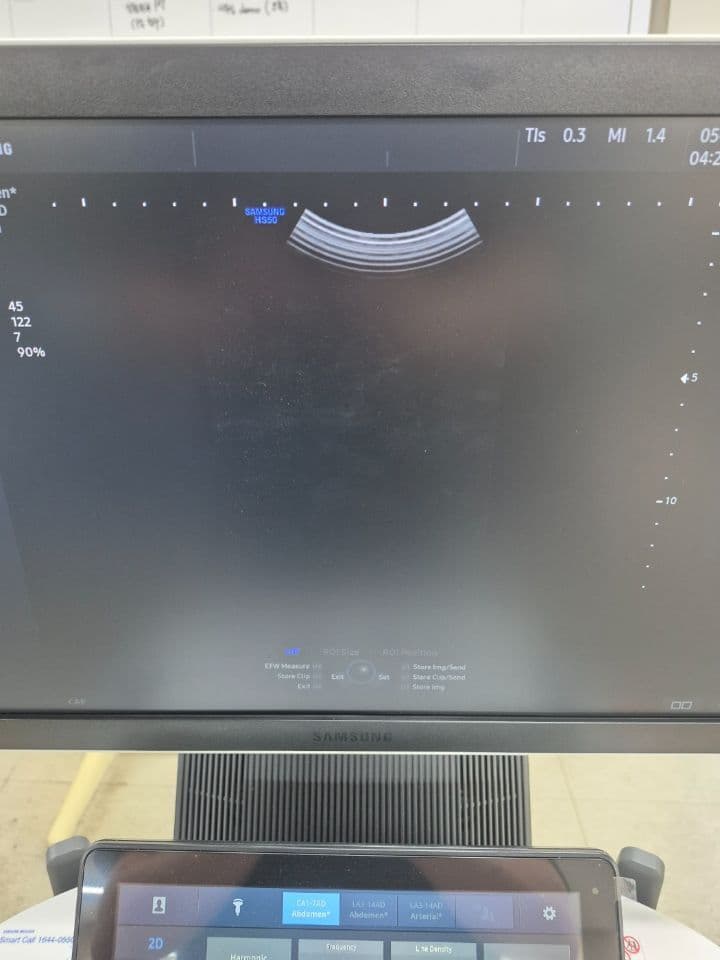 Convex Ultrasound Transducer — Samsung CA1-7AD thumbnail 5