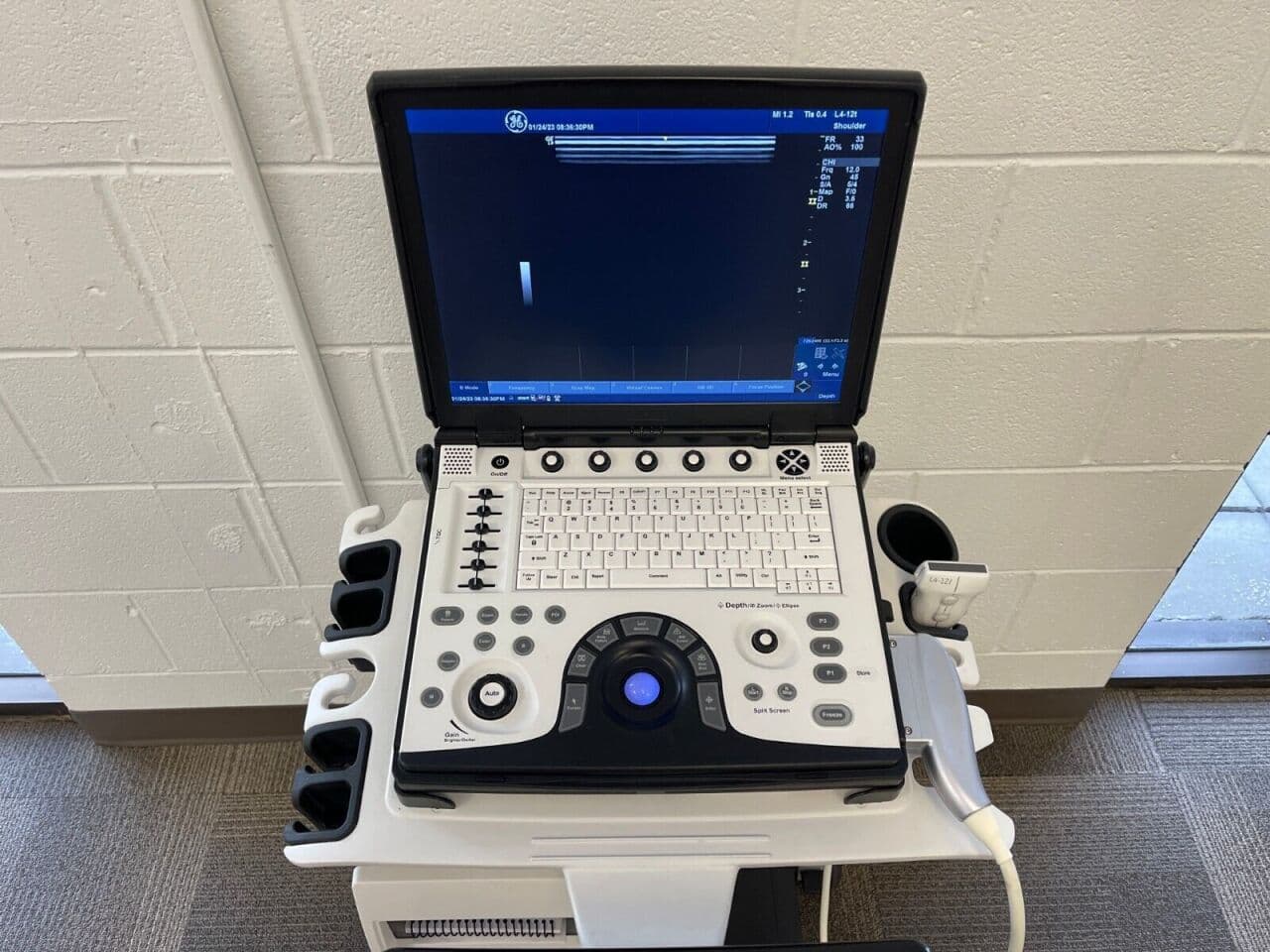 GE Healthcare Nextgen Logiq-e Portable Ultrasound System thumbnail 3