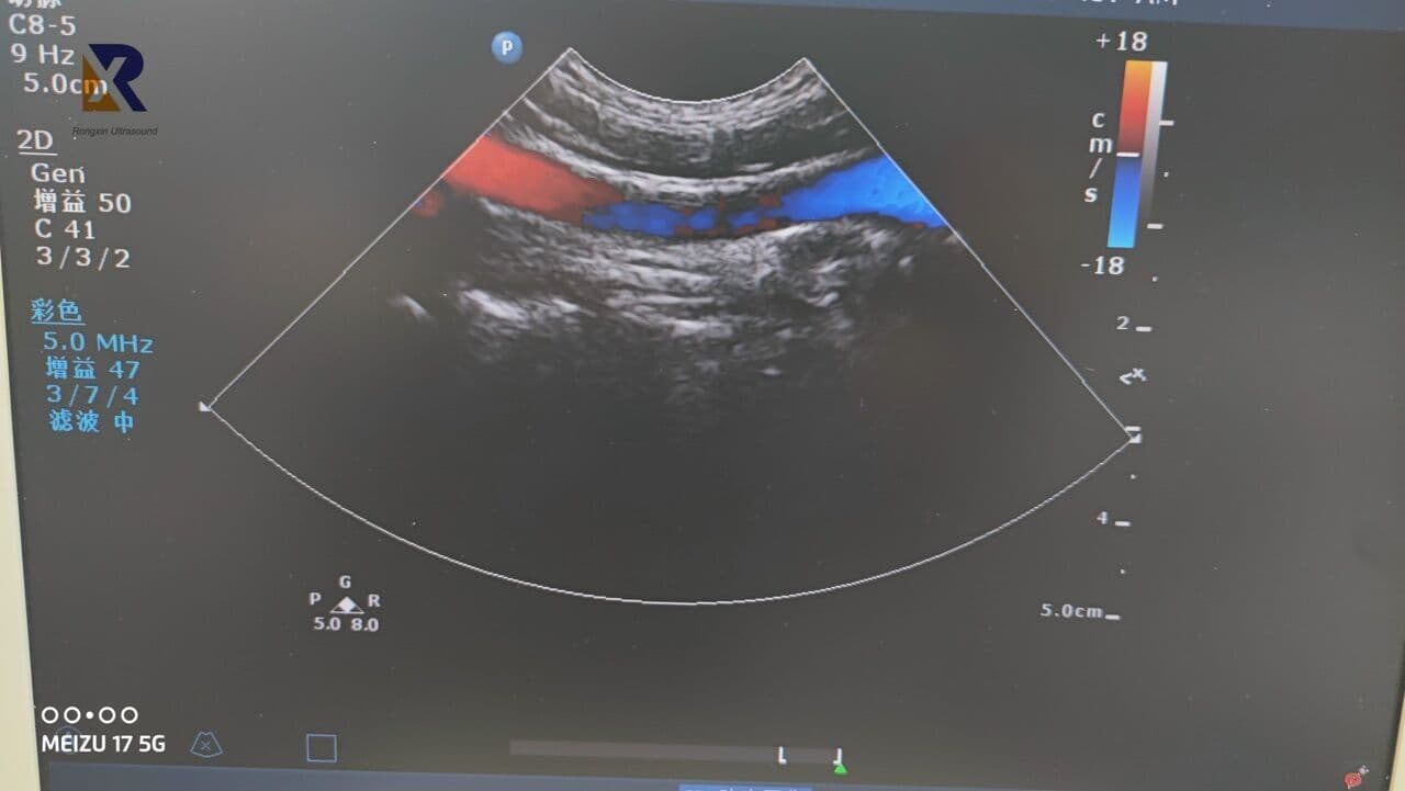 Philips C8-5 Curved Array Ultrasound Transducer for EPIQ, Affiniti, and CX50 Systems thumbnail 5