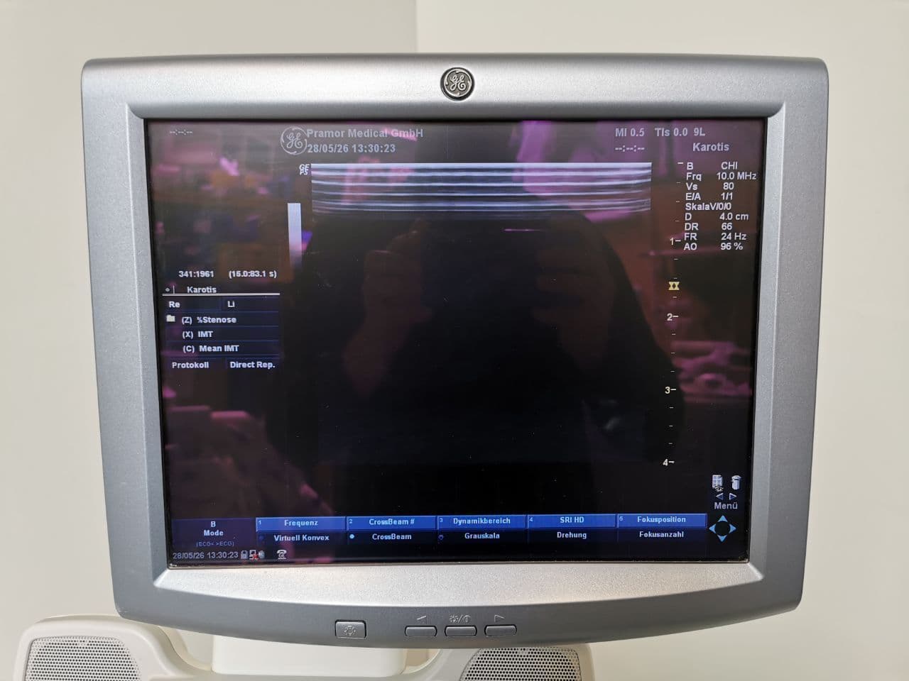 GE Healthcare 9L Linear Ultrasound Probe thumbnail 6
