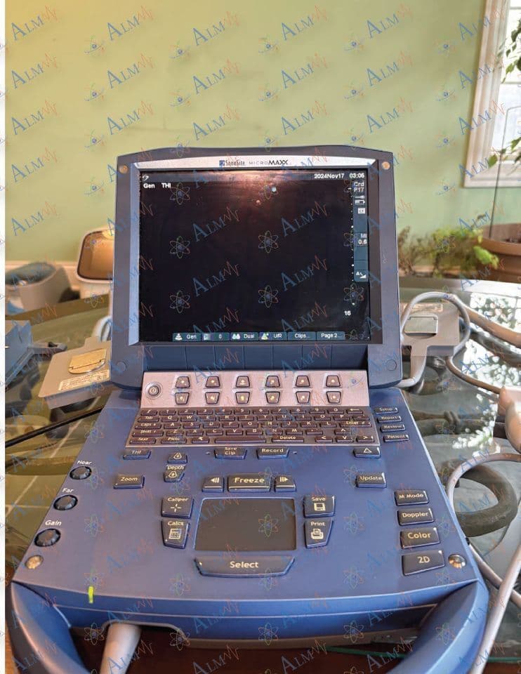 Portable Ultrasound System — Sonosite MicroMaxx with Cardiac & Vascular Probes thumbnail 2