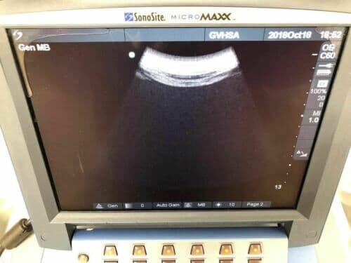 Sonosite C60e Convex Ultrasound Transducer Probe thumbnail 3