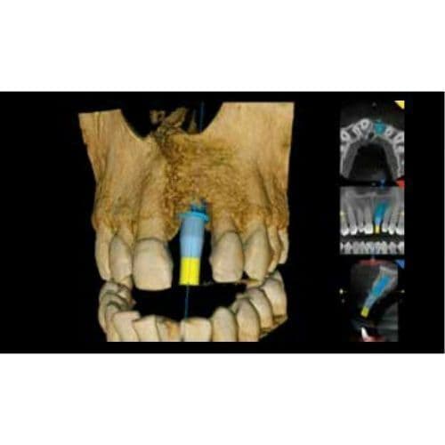 Carestream CS8100 3D Panoramic and CBCT Dental X-Ray System (2020) thumbnail 5