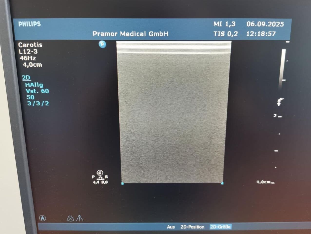 Philips L12-3 Linear Array Ultrasound Transducer thumbnail 4