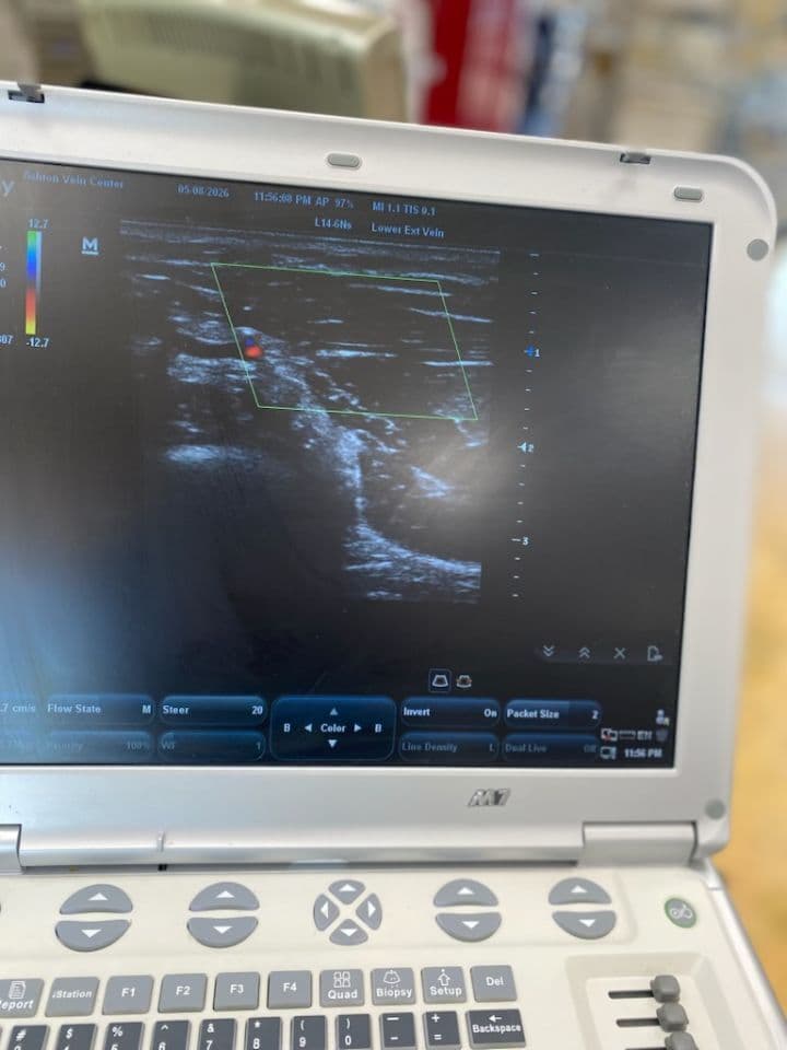 Mindray M7 Vein Ultrasound System with Trolley thumbnail 5