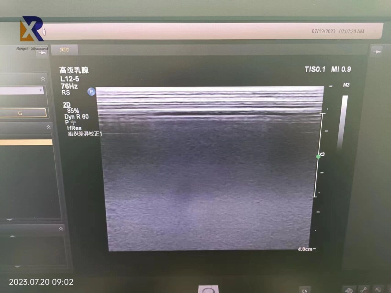 Philips L12-5 Linear Array Ultrasound Transducer for EPIQ, Affiniti, and CX50 thumbnail 4