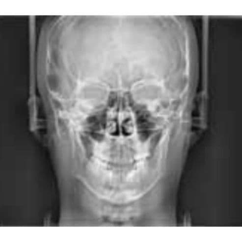 Vatech PaX-i Pan/Ceph Dental X-Ray System thumbnail 7