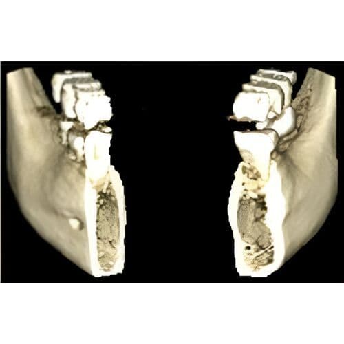 Planmeca Pan + CBCT (8x8 FOV) 3D Dental X-Ray System thumbnail 3