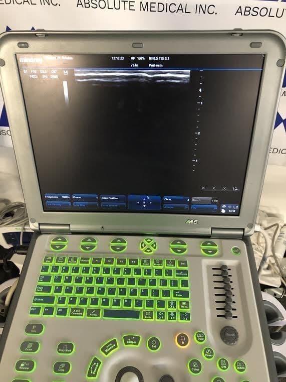 Mindray M5 Portable Ultrasound System thumbnail 5