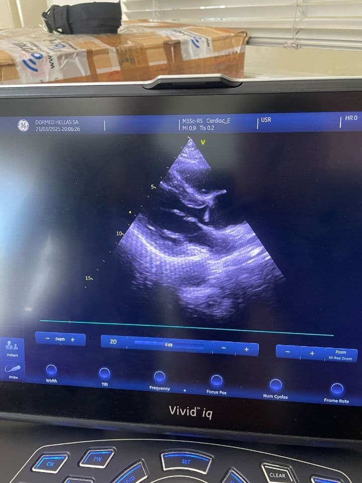 For Sale GE HEALTHCARE Vivid iq Ultrasound System thumbnail 2