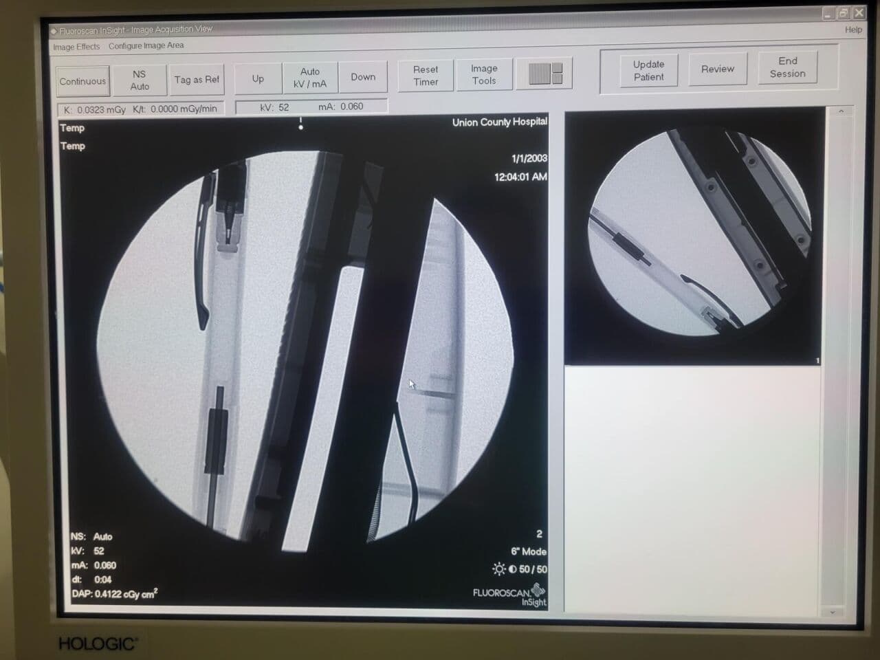 Hologic Fluoroscan InSight 2 Digital Mini C-Arm System thumbnail 4