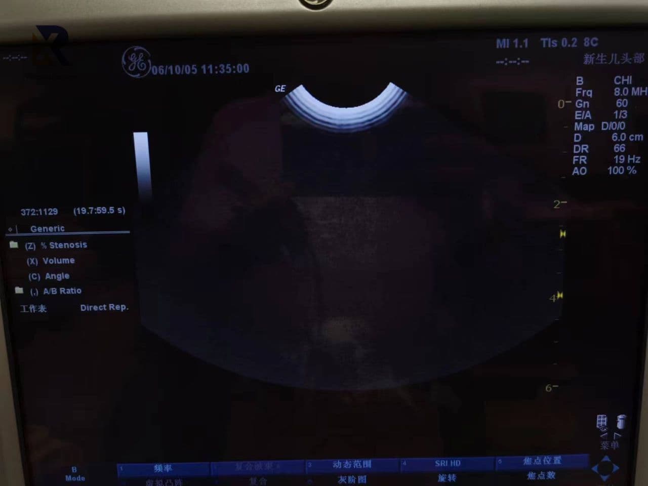 GE 8C Micro-Convex Array Ultrasound Transducer thumbnail 4