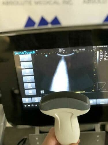 CHISON Sonotouch 30 Portable Ultrasound System with Touchscreen Interface thumbnail 7