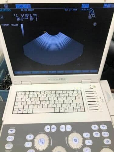 Siemens Acuson P300 Portable Diagnostic Ultrasound System