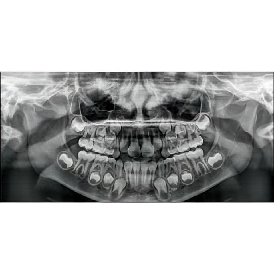 Carestream CS8100 Pano Panoramic Dental X-Ray System thumbnail 4