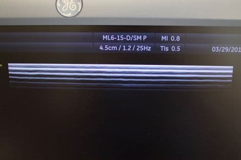 GE ML6-15-D Linear Matrix Ultrasound Transducer thumbnail 4