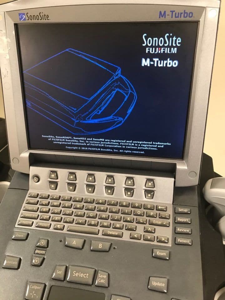 Sonosite M-Turbo Portable Shared Service Ultrasound System thumbnail 4