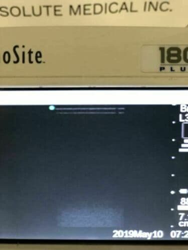 Sonosite 180 Plus Portable Ultrasound System with L38 Linear Vascular Probe thumbnail 6