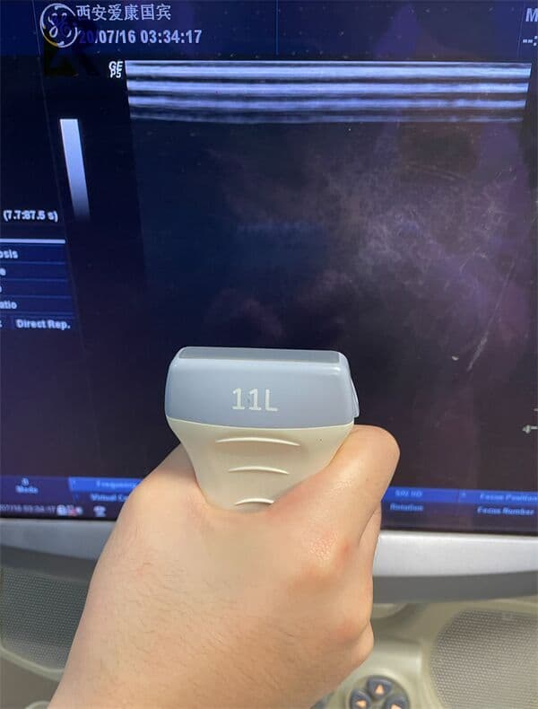 GE Logiq P5 Mobile Color Doppler Ultrasound System thumbnail 2
