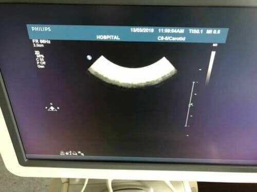 Philips C8-5 Convex Ultrasound Transducer Probe thumbnail 3
