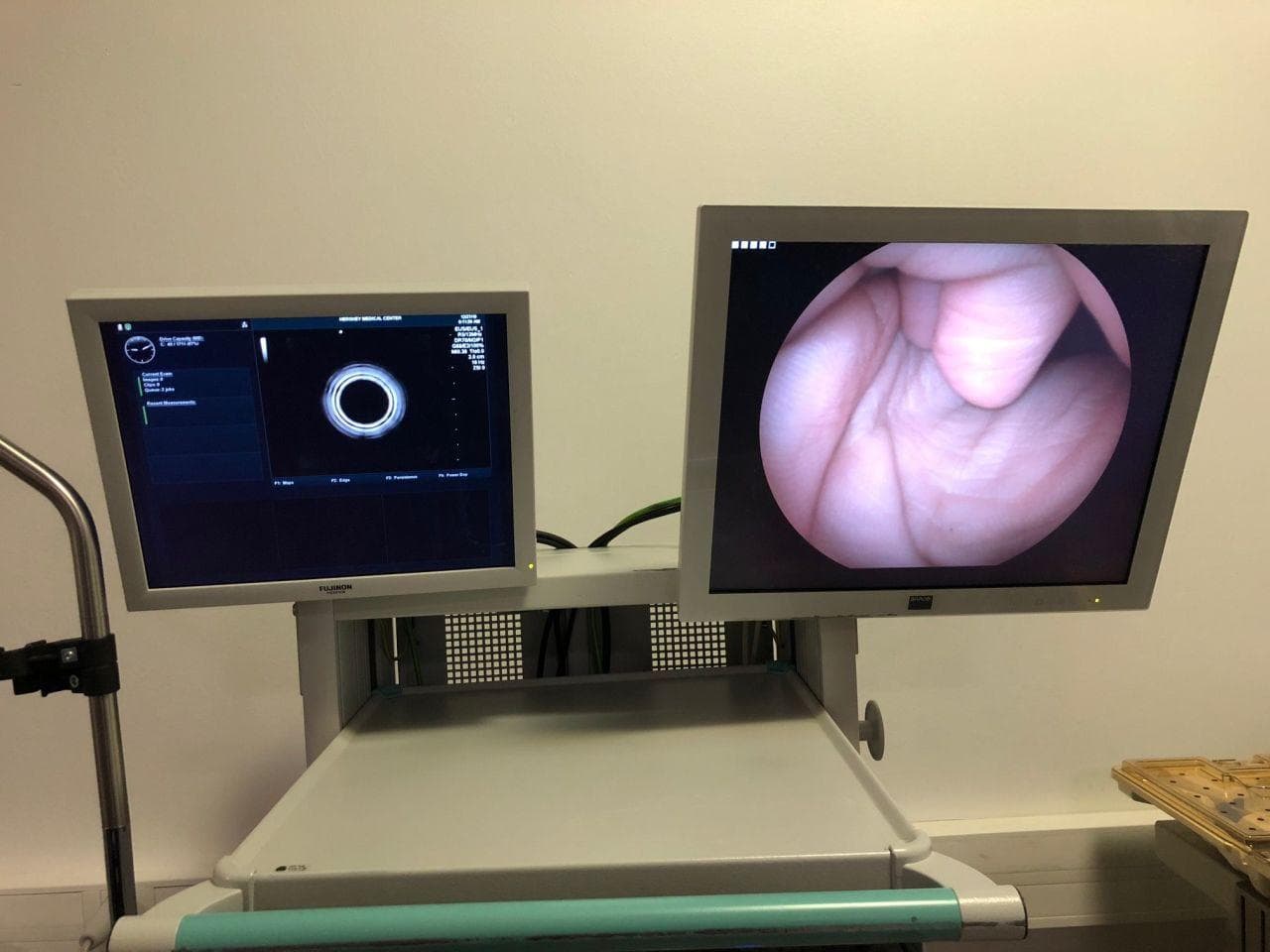 Fujinon EG-530UR Ultrasound Gastroscope for Endoscopic Ultrasonography thumbnail 6