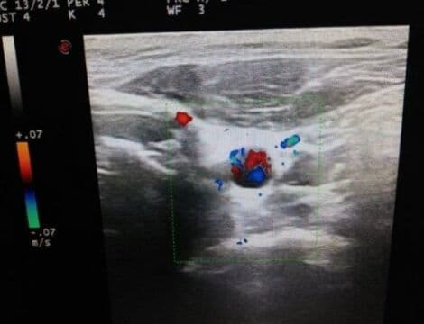 Kontron LA523K Linear Ultrasound Transducer for Esaote Technos thumbnail 7