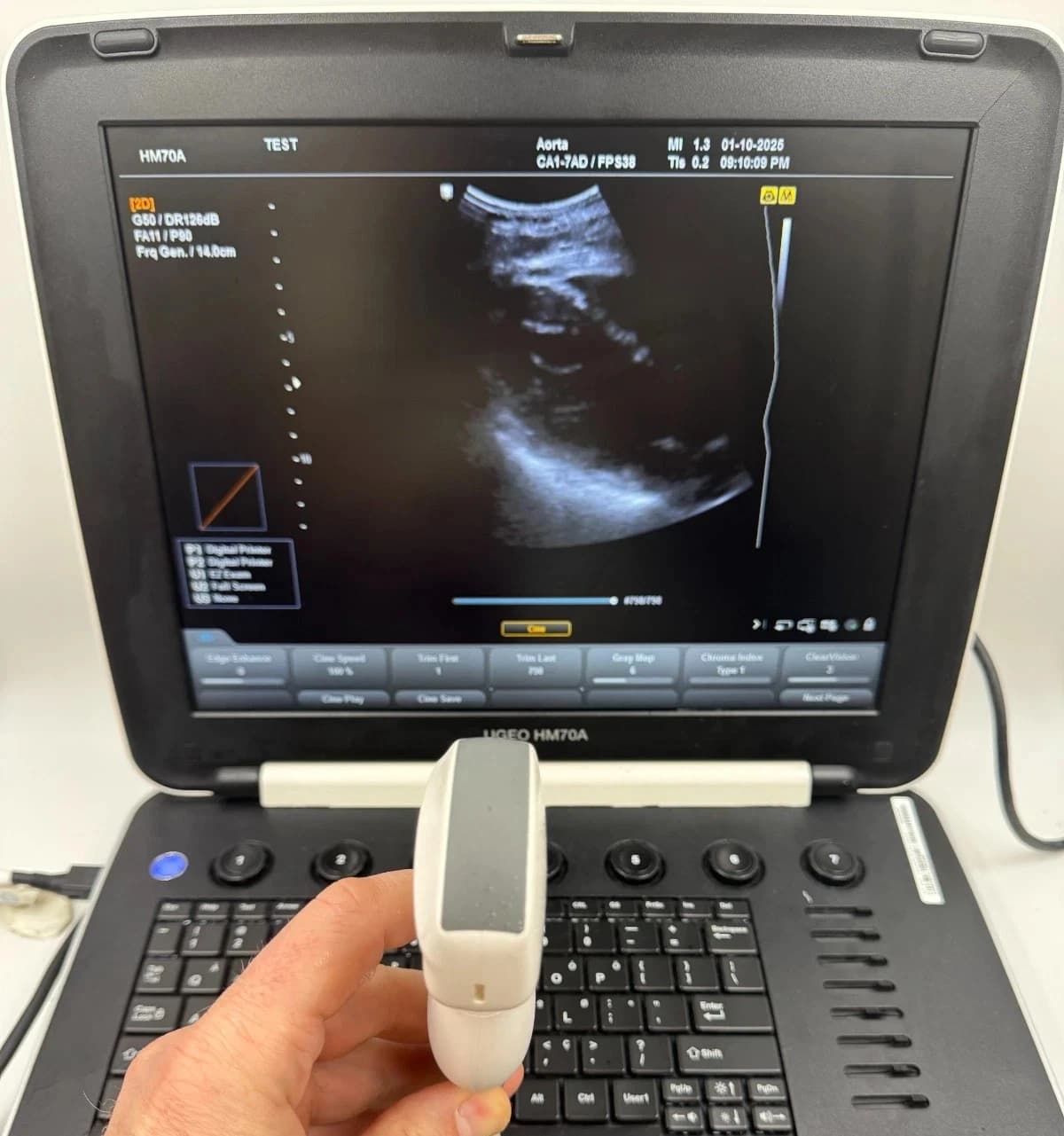 Samsung CA1-7AD Single Crystal Convex Ultrasound Probe