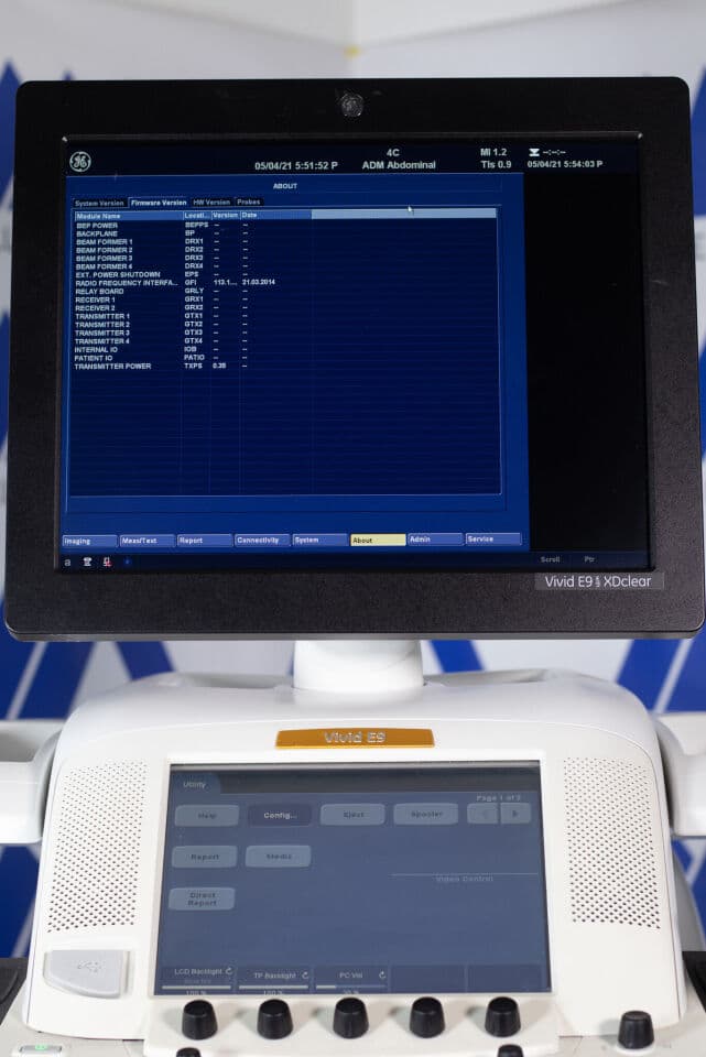 GE Vivid E9 XD Clear Cardiovascular Ultrasound System thumbnail 6