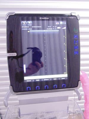 GE Venue 40 BT12 Point-of-Care Ultrasound System thumbnail 2