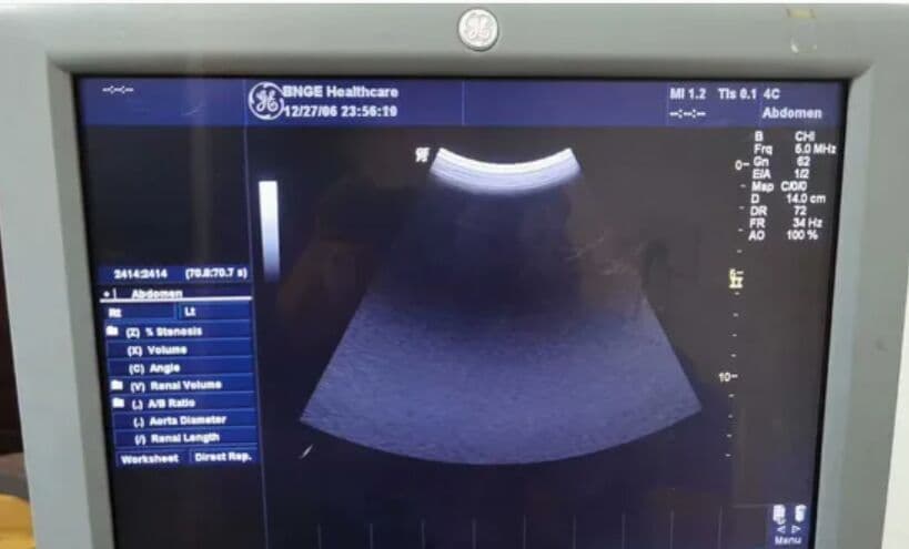 GE FW15LXG 15-inch LCD Monitor for Logiq P5 Ultrasound image 1