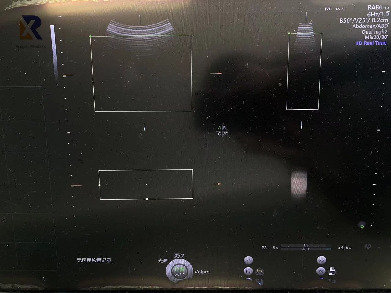 GE RAB6-D 3D/4D Curved Array Ultrasound Transducer thumbnail 3