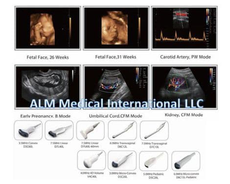 Chison Q5 Multi-Application Ultrasound System thumbnail 4