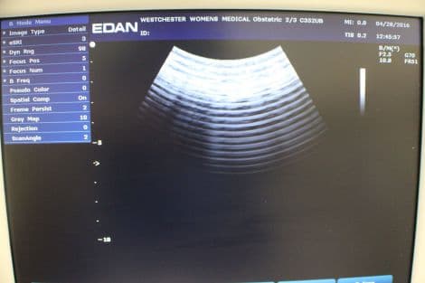 Edan C352UB Convex Array Ultrasound Transducer for U50 Systems thumbnail 2