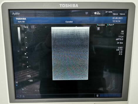 Linear Ultrasound Transducer — Toshiba PLT-704SBT thumbnail 5