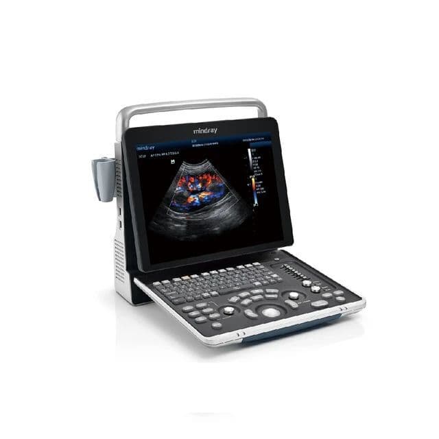 Mindray Z60 Portable Color Doppler Ultrasound System thumbnail 2