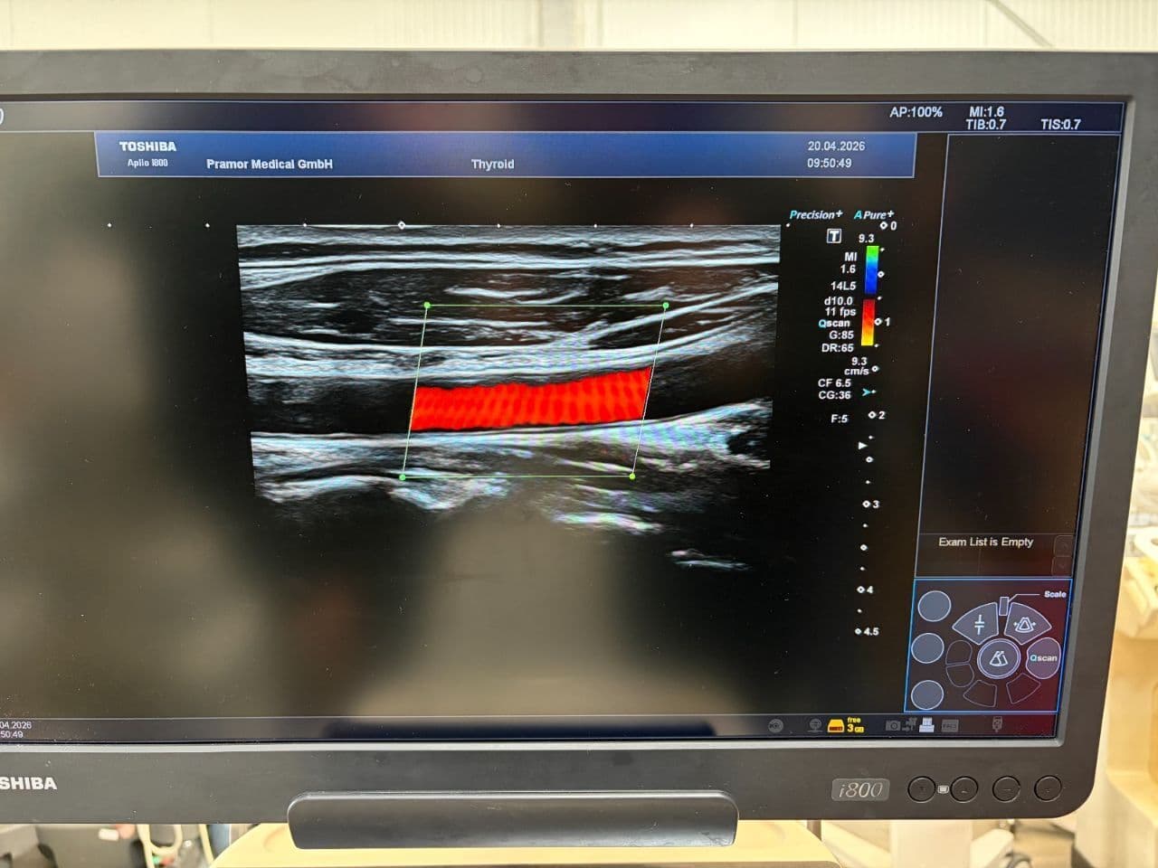 Toshiba PLT-1005BT Linear Ultrasound Probe thumbnail 9