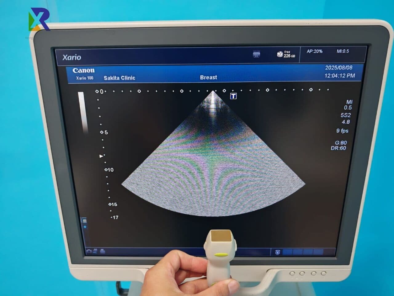 Canon Xario 100 / TUS-X100 Diagnostic Ultrasound System thumbnail 5