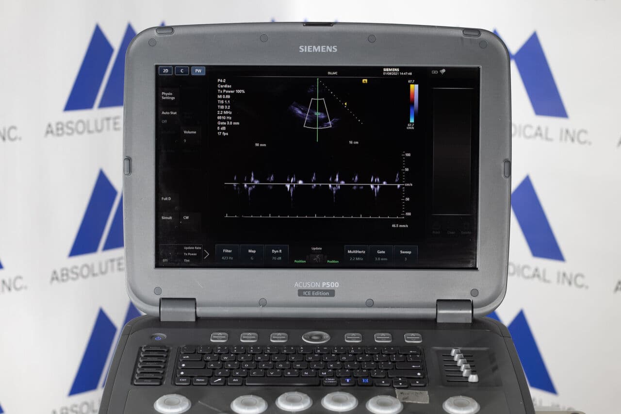 Siemens Acuson P500 Frosk Portable Ultrasound System thumbnail 9